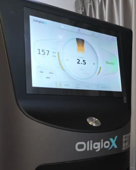 เครื่อง Oligio X ในห้องทำหัตถการของคลินิก